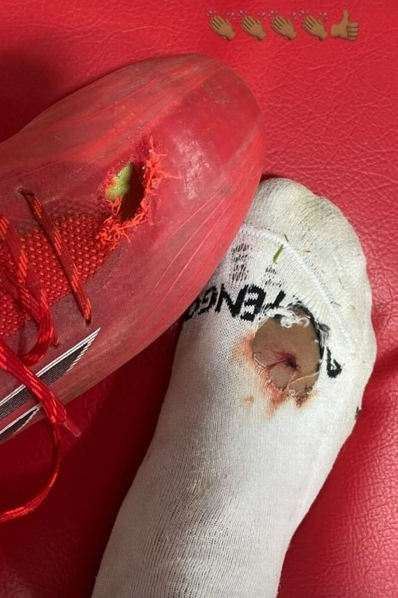 Na derrota por 1 a 0 o Peixe pouco criou e acabou eliminado nas quartas de final. (Foto: Reprodução/Instagram) Na derrota por 1 a 0 o Peixe pouco criou e acabou eliminado nas quartas de final. (Foto: Reprodução/Instagram)