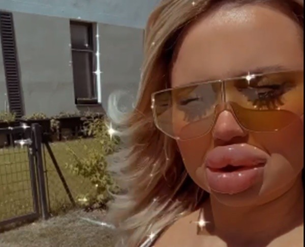 Modelo apareceu com lábios inchados. Foto: Reprodução/Instagram oficial Jessy Bunny Modelo apareceu com lábios inchados. Foto: Reprodução/Instagram oficial Jessy Bunny