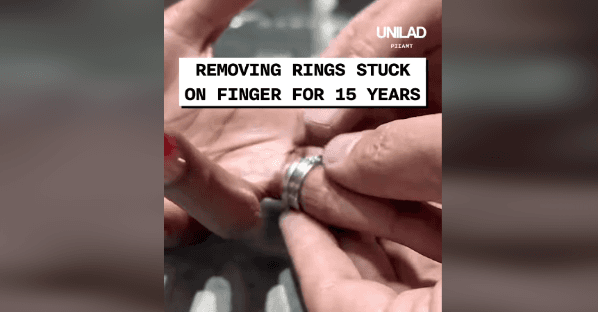 Anel ficou preso por 15 anos - Foto: UNILAD